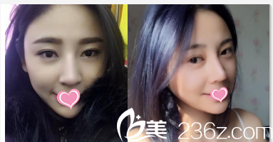 北京圣嘉榮黃大勇隆鼻<span style= 北京圣嘉榮黃大勇隆鼻<span style=