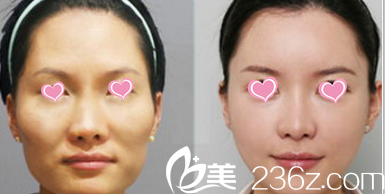 北京圣嘉榮黃大勇面部脂肪填充<span style= 北京圣嘉榮黃大勇面部脂肪填充<span style=