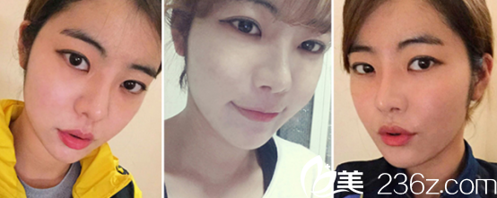 現(xiàn)在我越看眼睛和鼻子越順暢