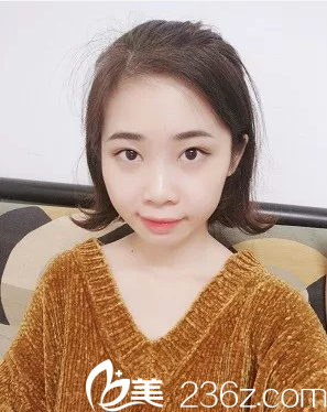 深圳健麗醫(yī)療美容醫(yī)院陳雪濤不開刀祛眼袋和雙眼皮案例術(shù)后一個(gè)月效果圖 深圳健麗醫(yī)療美容醫(yī)院陳雪濤不開刀祛眼袋和雙眼皮案例術(shù)后一個(gè)月效果圖