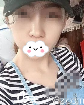 術(shù)后10天 術(shù)后10天