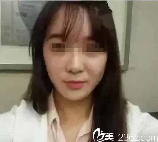 術(shù)前法令為和淚溝明顯 術(shù)前法令為和淚溝明顯