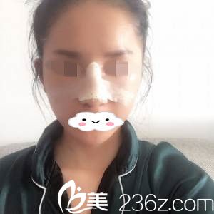 術(shù)后第二天