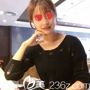 脂肪填充全臉半個月情況 脂肪填充全臉半個月情況