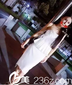 貴陽(yáng)美萊梁潔假體隆胸術(shù)后兩個(gè)月