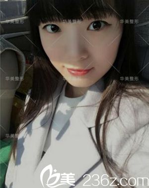 雙眼皮術前 雙眼皮術前