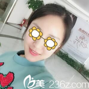 在長沙艾依美做過一次雙眼皮的我這次又來找金鵬院長給我做自體脂肪填充面部