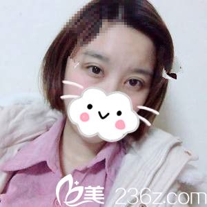 手術(shù)第20天