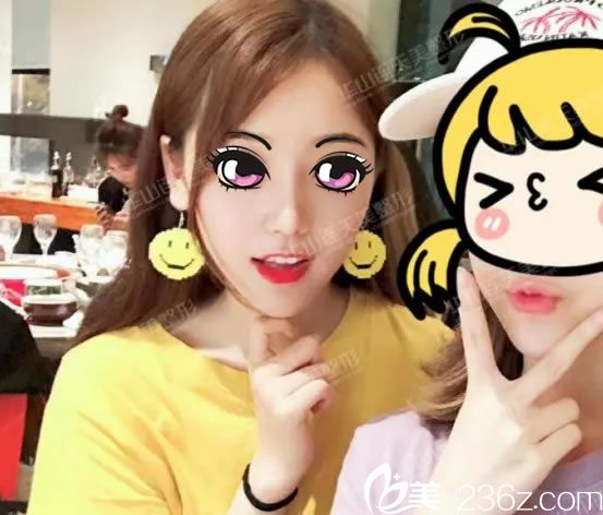 鼻部奧美定取出后15天效果