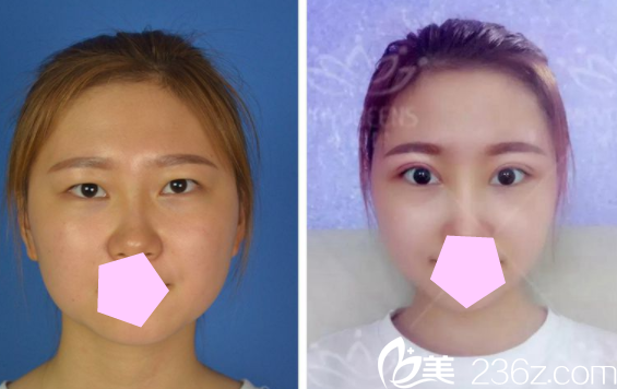 20180719_1531986085257327.png 2.png