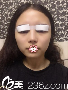 王志軍醫(yī)生幫我做完手術(shù)當(dāng)天