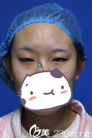 手術(shù)前照片 手術(shù)前照片