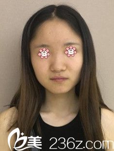 我的術(shù)前照 我的術(shù)前照