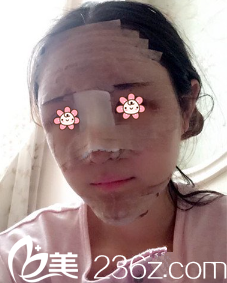 何山醫(yī)生給我做完手術(shù)當(dāng)天 何山醫(yī)生給我做完手術(shù)當(dāng)天