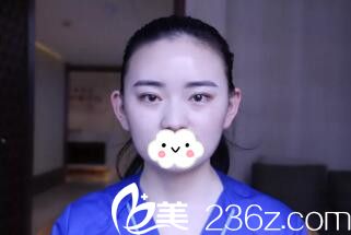 發(fā)際線移植前 發(fā)際線移植前