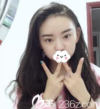 發(fā)際線種植一個月 發(fā)際線種植一個月