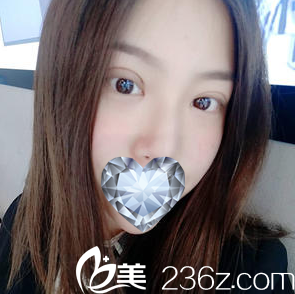 術(shù)后1個月恢復(fù)效果 術(shù)后1個月恢復(fù)效果