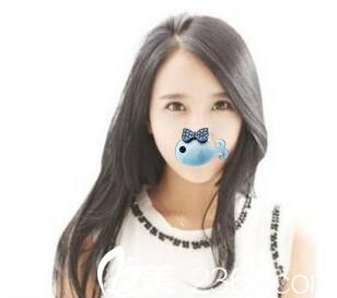 濮陽源美溫賞面部脂肪填充恢復后 濮陽源美溫賞面部脂肪填充恢復后