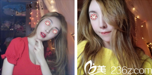 貴陽美貝爾可靠嗎？我也是打從廖小飛那兒做了種植發(fā)際線才知道。