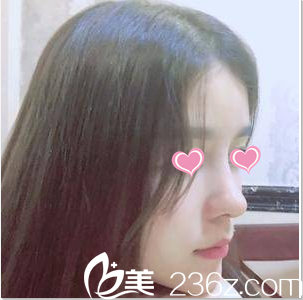 北京京美王歷鼻綜合<span style= 北京京美王歷鼻綜合<span style=