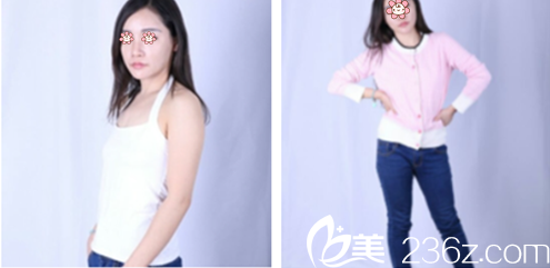 打算整形前我對(duì)比了新疆A優(yōu)醫(yī)美-王蛟整形和烏魯木齊伊麗莎白整形 打算整形前我對(duì)比了新疆A優(yōu)醫(yī)美-王蛟整形和烏魯木齊伊麗莎白整形