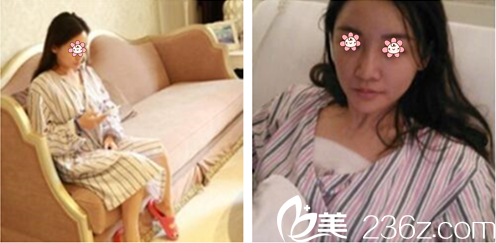 張寶譽(yù)主任給我術(shù)后第三天 張寶譽(yù)主任給我術(shù)后第三天