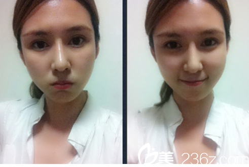 真的年輕了好多啊