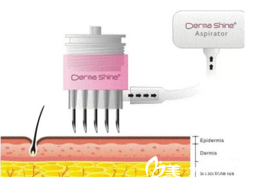 長春萊美注射多少錢？1120元起幫你塑造水光肌