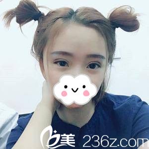 術(shù)后25天 術(shù)后25天