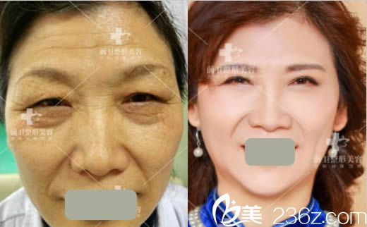 宜昌前衛(wèi)整形皮膚年輕化案例圖 宜昌前衛(wèi)整形皮膚年輕化案例圖
