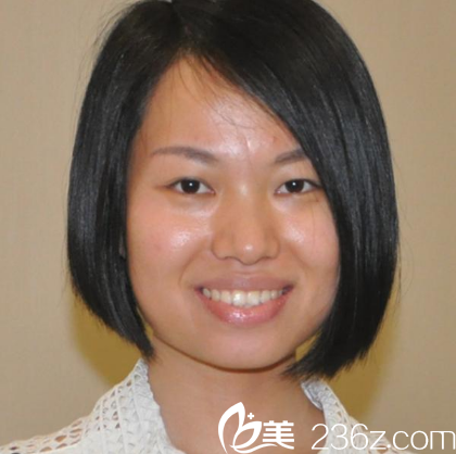 選擇深圳富華醫(yī)療美容醫(yī)院做雙眼皮前的術(shù)前照片 選擇深圳富華醫(yī)療美容醫(yī)院做雙眼皮前的術(shù)前照片