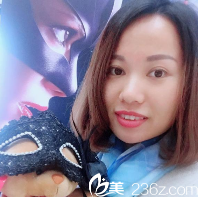 深圳富華醫(yī)療美容醫(yī)院做的雙眼皮兩個月效果圖 深圳富華醫(yī)療美容醫(yī)院做的雙眼皮兩個月效果圖