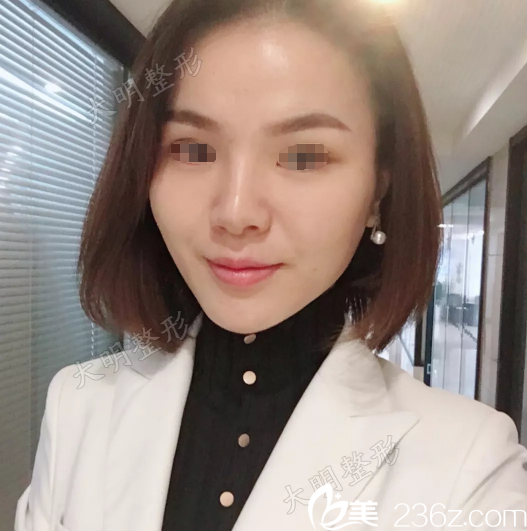 連云港大明整形張培鑒院長分享：3D全面部線雕+下頜緣提升真人案例，抗衰除皺聯(lián)合運用效果更好