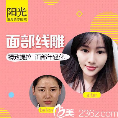 整形醫(yī)院陳瑞紅院長面部<span style= 整形醫(yī)院陳瑞紅院長面部<span style=