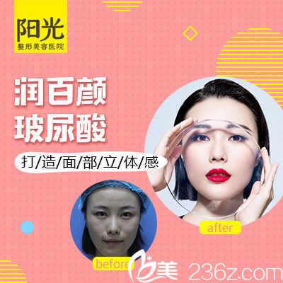 整形醫(yī)院陳瑞紅院長玻尿酸面部填充案例圖 整形醫(yī)院陳瑞紅院長玻尿酸面部填充案例圖