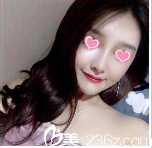 北京畫美硅膠隆鼻<span style= 北京畫美硅膠隆鼻<span style=