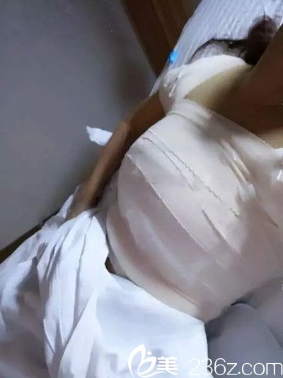 手術(shù)后 手術(shù)后