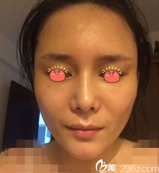 選擇寧波童顏?zhàn)鲋咎畛?天<span style= 選擇寧波童顏?zhàn)鲋咎畛?天<span style=