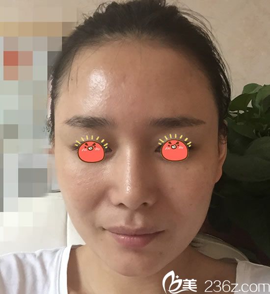 在寧波童顏?zhàn)鲋咎畛?6天<span style= 在寧波童顏?zhàn)鲋咎畛?6天<span style=