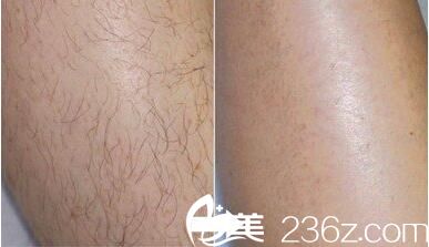 20180801_1533116053197885.jpg 20180525111303541.jpg