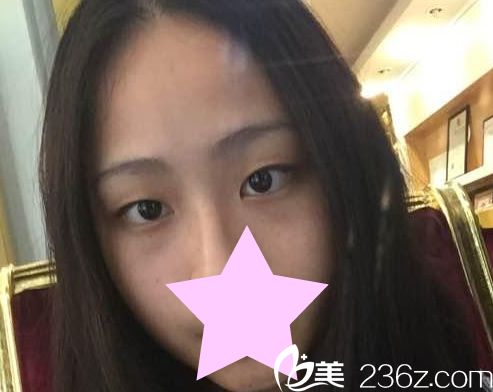 韓國紫馨整形美容手術(shù)前 韓國紫馨整形美容手術(shù)前