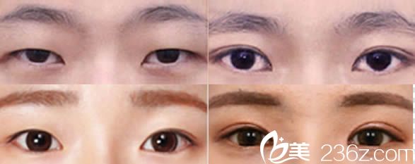 韓國(guó)然美之眼綜合整形<span style= 韓國(guó)然美之眼綜合整形<span style=