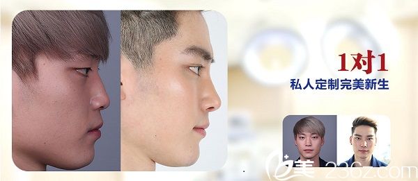 韓國諾寶絲整形醫(yī)院案例 韓國諾寶絲整形醫(yī)院案例