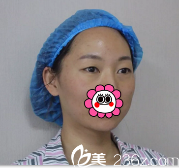 術前眼睛無神想做雙眼皮 術前眼睛無神想做雙眼皮