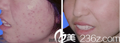 韓國ROCOCO皮膚美容效果