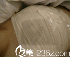 術后三天被包得嚴嚴實實 術后三天被包得嚴嚴實實