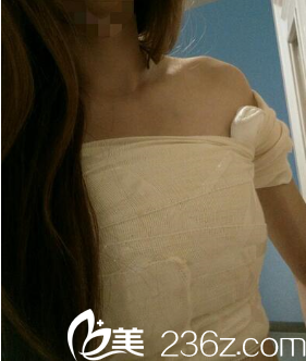 尹盛浩院長給我做完手術第六天 尹盛浩院長給我做完手術第六天