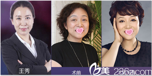 北京美萊王秀祛斑美膚<span style= 北京美萊王秀祛斑美膚<span style=