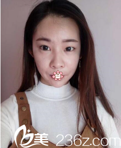 我的術(shù)前照片 我的術(shù)前照片