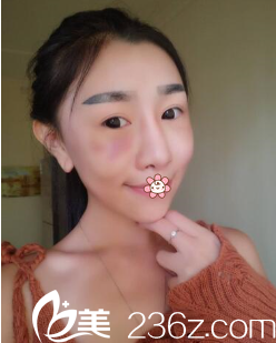 朱曉東醫(yī)生剛給我做完手術(shù)第二天 朱曉東醫(yī)生剛給我做完手術(shù)第二天